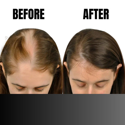 Before and after comparison of hair growth on a person's head.